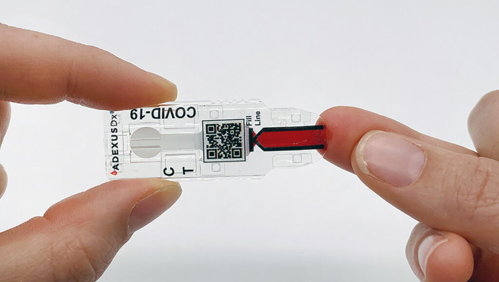 ADEXUSDx test for COVID-19 antibodies.